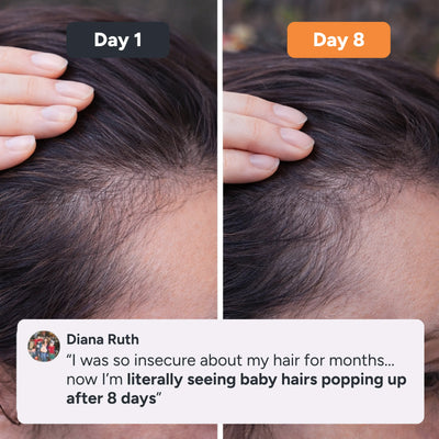 dermaboost™ Growth Serum