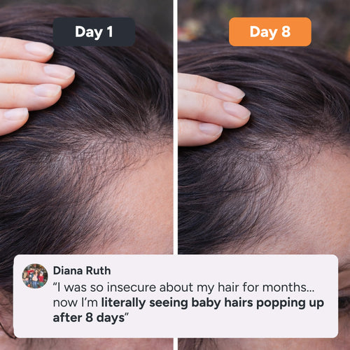 dermaboost™ Growth Serum